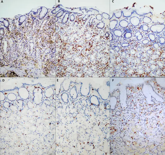Mucosa-Associated Lymphoid Tissue : 粘膜相关淋巴组织