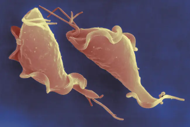 Trichomonas Vaginalis : 阴道滴虫