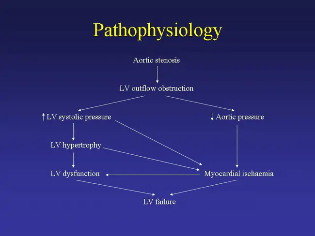 Valvular Heart Disease : 瓣膜性心脏病