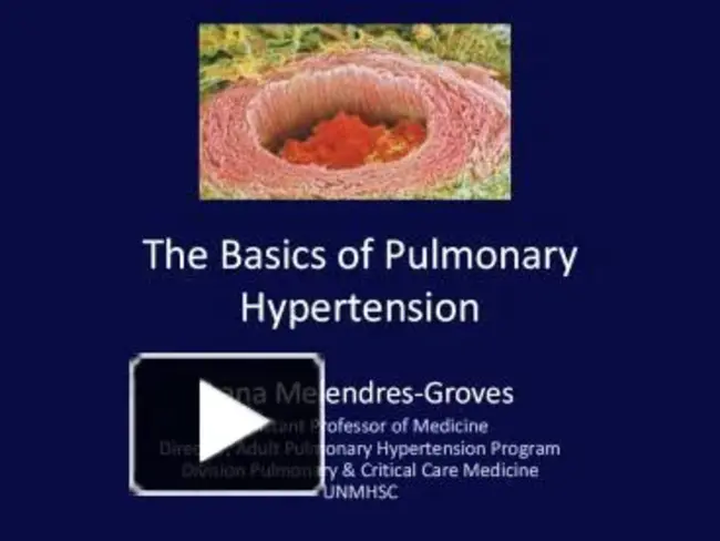 World Symposium on Pulmonary Hypertension : 世界肺动脉高压研讨会