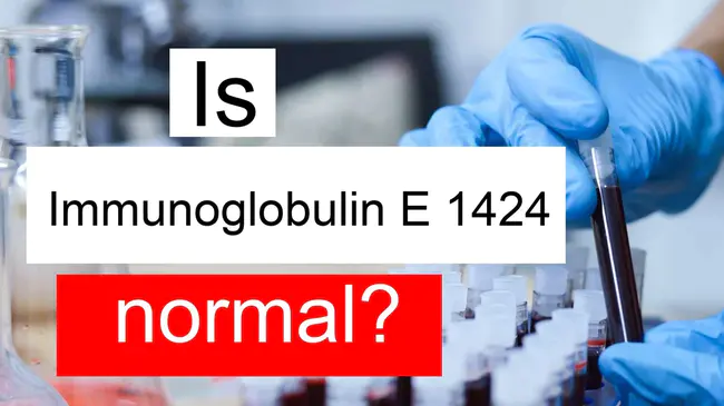 secretory immunoglobulin A : 分泌免疫球蛋白A