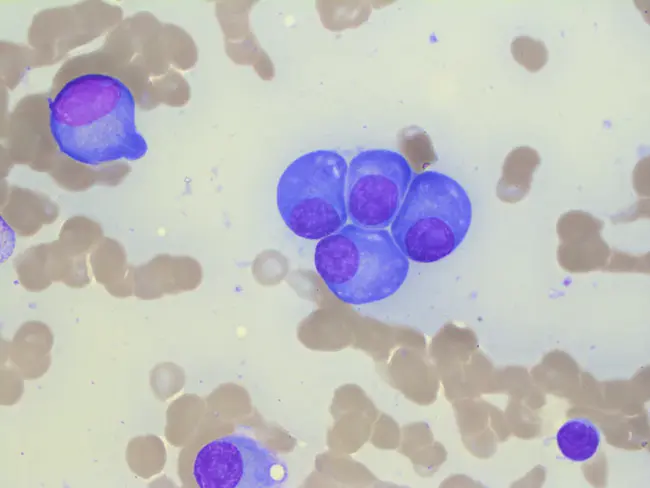 Plasma Electrolytic Oxidation : 等离子体电解氧化