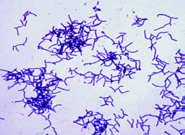 Actinomyces : 放线菌属