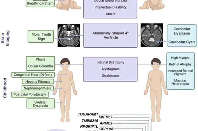 Acute Brain Syndrome : 急性脑综合征