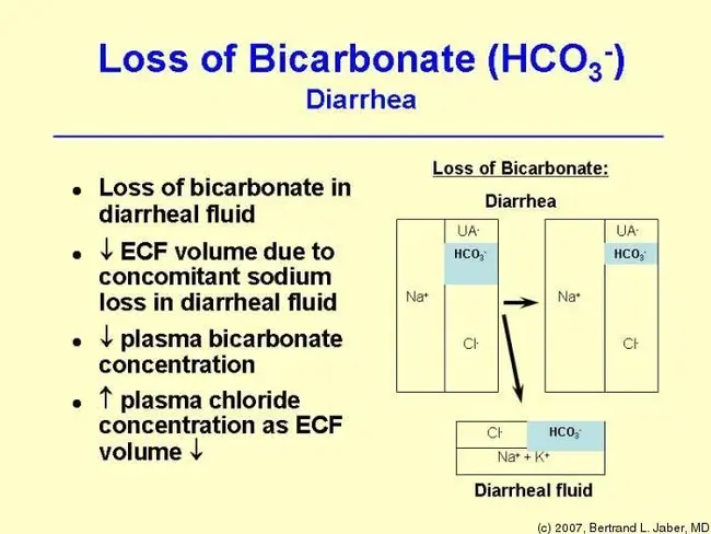 Acute Metabolic Acidosis : 急性代谢性酸中毒