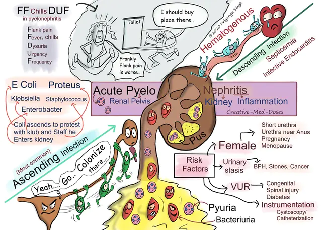 Acute Tonsillitis : 急性扁桃体炎