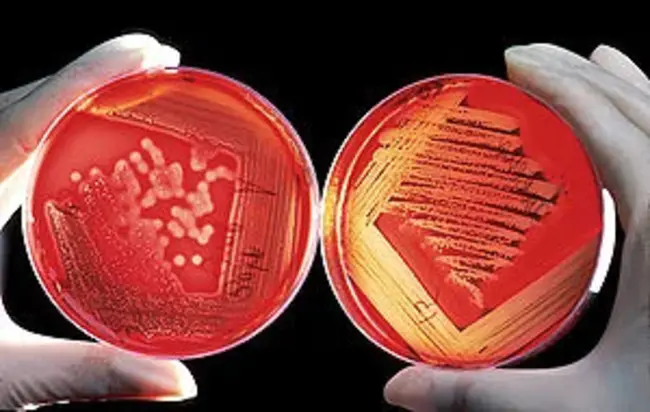 Agar Diffusion Test : 琼脂扩散试验