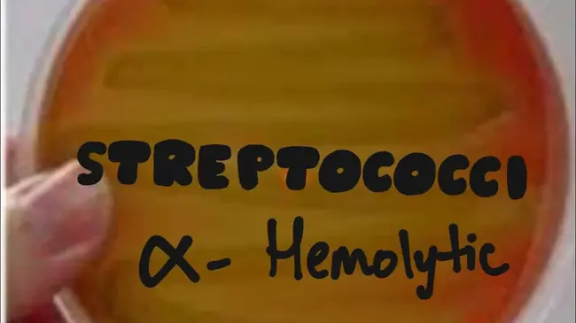 Alpha Haemolytic Streptococci : α溶血性链球菌