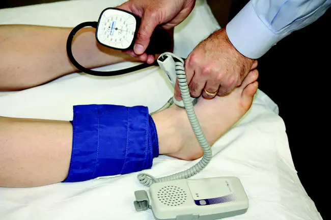 ankle/brachial blood pressure index : 踝/臂血压指数