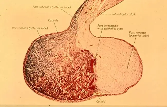 Anterior Pituitary-Like : 垂体前叶样