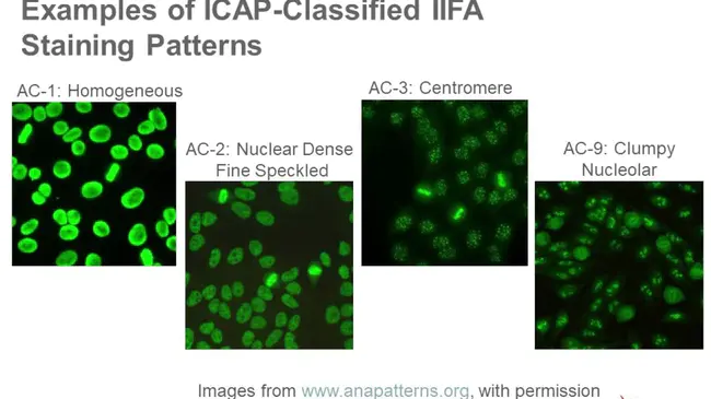 Anti-Centromere Antibody : 抗着丝粒抗体