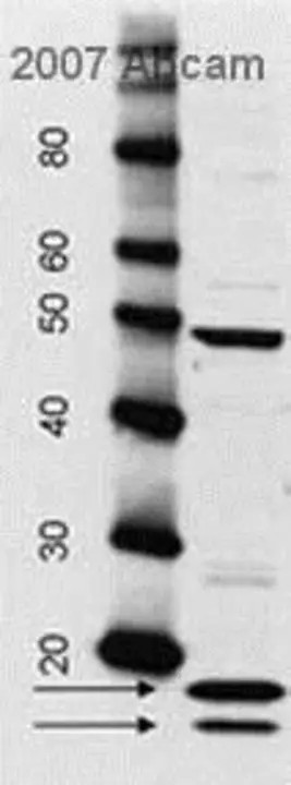 Anti-Histone Antibody : 抗组蛋白抗体