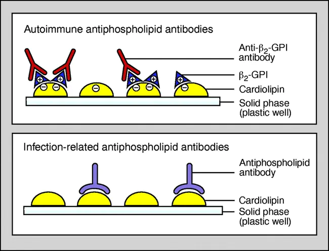 antiphospholipid : 抗磷脂