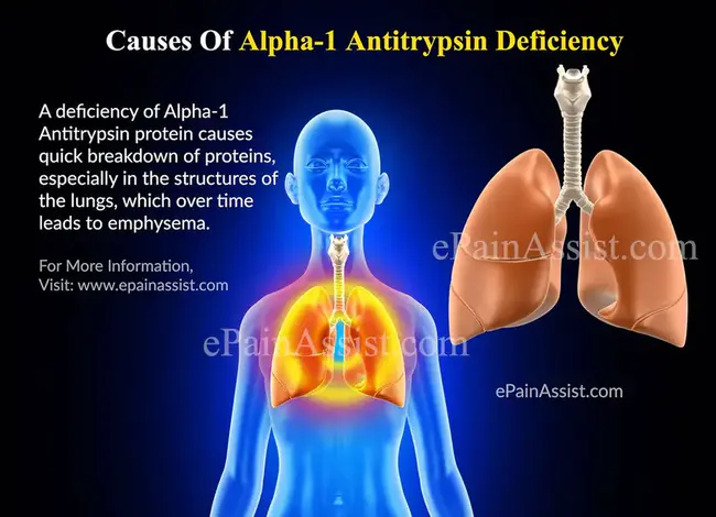 antitrypsin : 抗胰蛋白酶