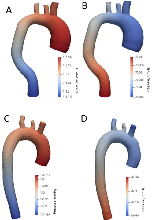 Aortic Diastolic Pressure : 主动脉舒张压