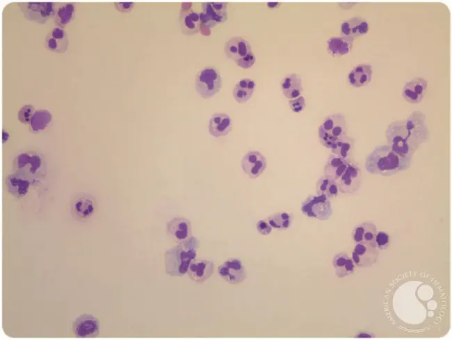 Apoptotic Index : 凋亡指数