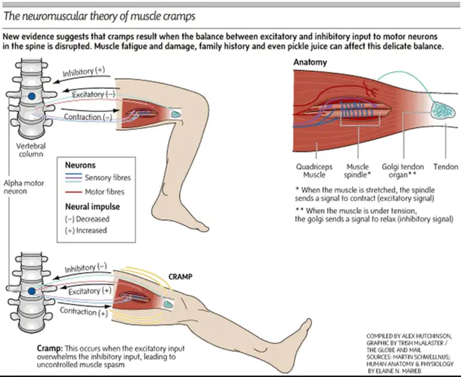 Arterial Pressure Lability : 动脉压不稳定