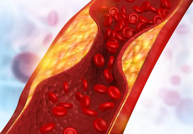 Arterialised Capillary Blood : 动脉化毛细血管血