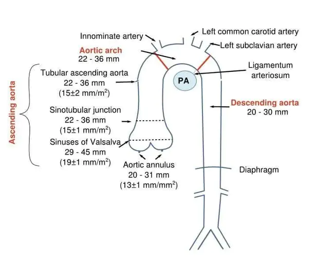 Ascending Aorta : 升主动脉