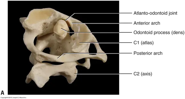 Atlanto-Odontoid : 大西洋齿状样