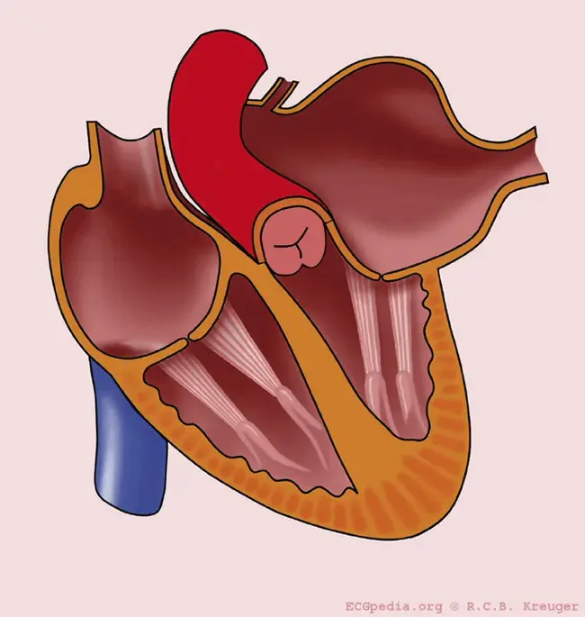 Atrial Premature Depolarisation : 心房过早去极化