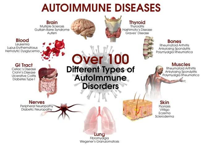 autoimmune : 自身免疫