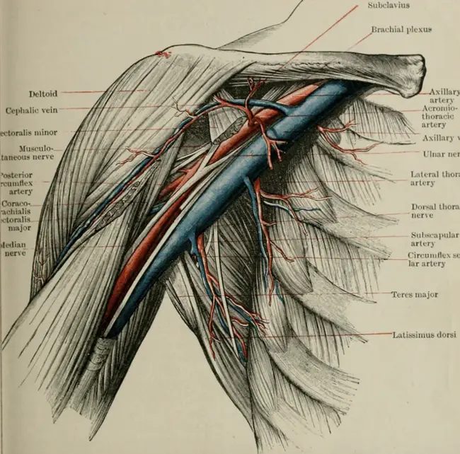 Axillary Dissection : 腋窝解剖