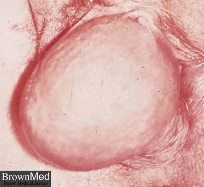 Bartholin, Skene, and Urethral glands : 前庭大腺、睾丸和尿道腺