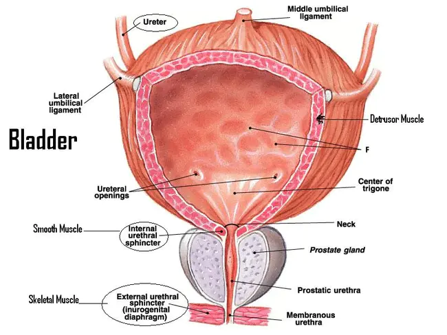 Bladder Tumour : 膀胱肿瘤