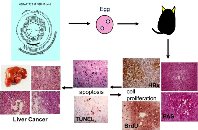 Bound Hepatitis Antigen : 结合型肝炎抗原