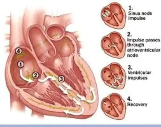 Bradycardia-Tachycardia Syndrome : 心动过缓-心动过速综合征