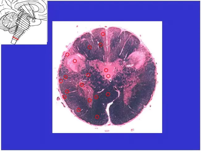 Brain Stem : 脑干