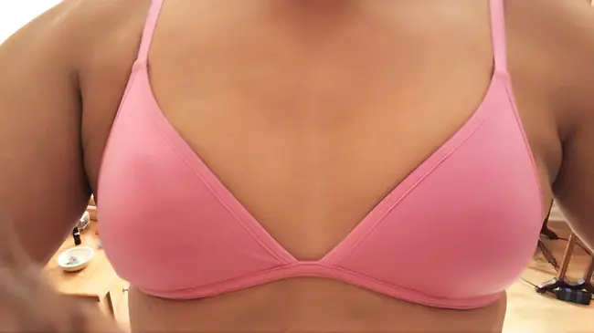 Breast Reduction : 乳房缩小术