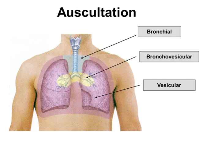 Bronchial Reactivity : 气道反应性