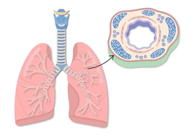 Bronchial Response : 支气管反应