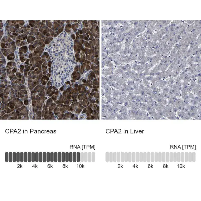 carboxypeptidase A : 羧肽酶A