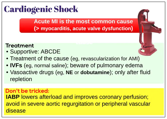 Cardiogenic Shock : 心源性休克