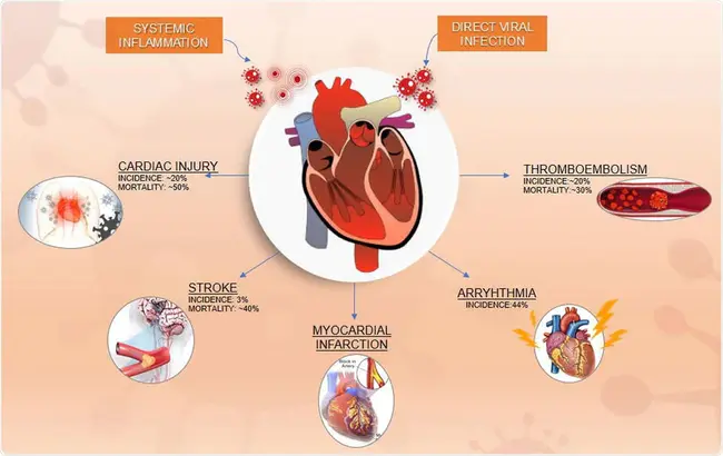 cardiovascular event : 心血管事件