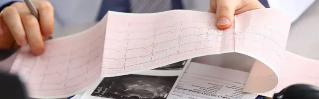 Cardiovascular Health Study : 心血管健康研究