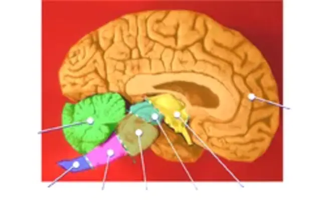 cerebellopontine angle : 桥小脑角