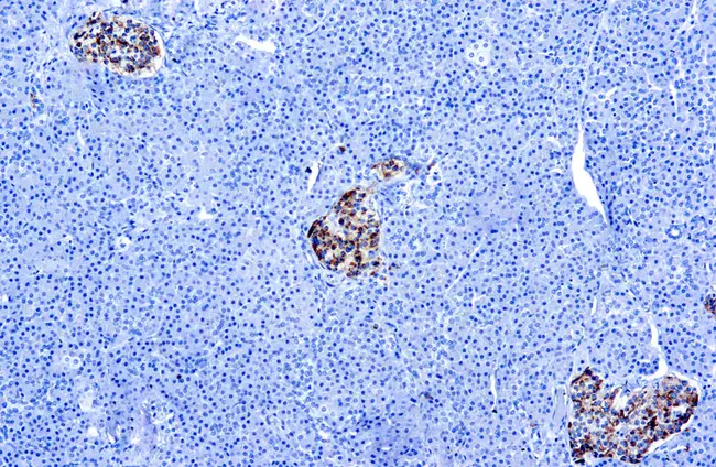 chromogranin A and B : 嗜铬粒蛋白A和B