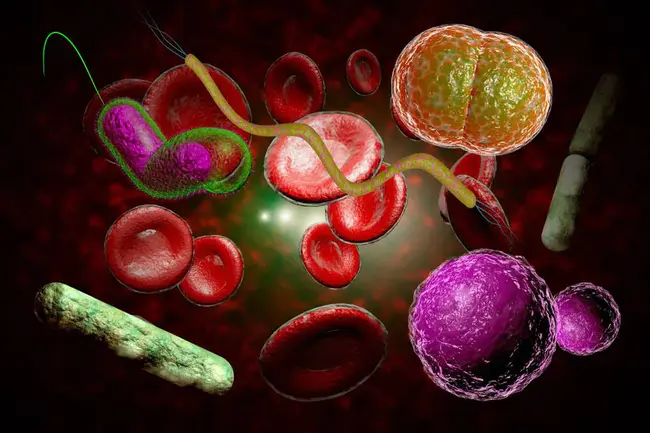 Chronic Venous Disease : 慢性静脉疾病