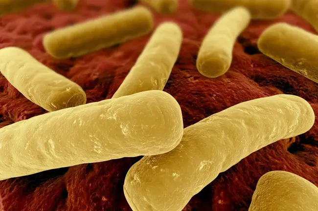 Clostridium difficile colitis : 艰难梭菌性结肠炎