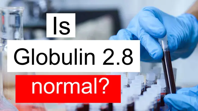 Cold Insoluble Globulin : 冷不溶性球蛋白