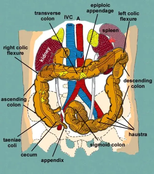 Colon Resection : 结肠切除术