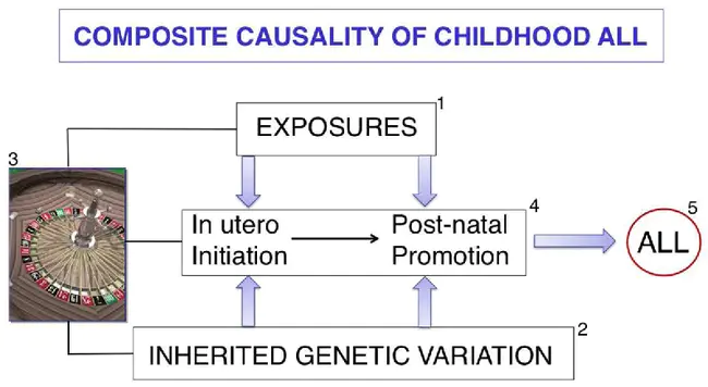 Common Acute Lymphoblastic Leukaemia : 常见急性淋巴细胞白血病