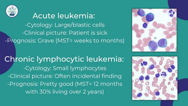 Common Acute Lymphocytic Leukaemia : 常见急性淋巴细胞白血病