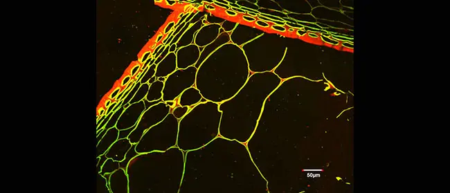 Confocal Laser Scanning : 共焦激光扫描