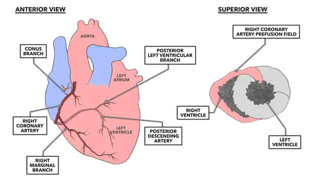 Coronary Reserve : 冠状动脉储备