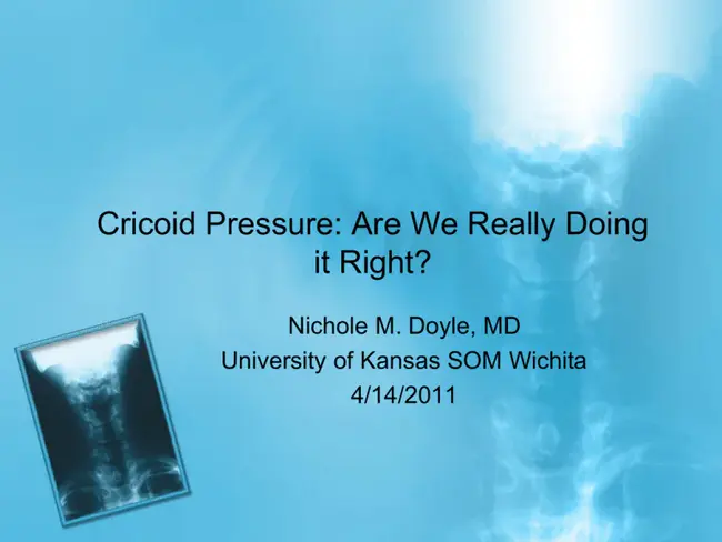 Cricoid Pressure : 环状软骨压迫